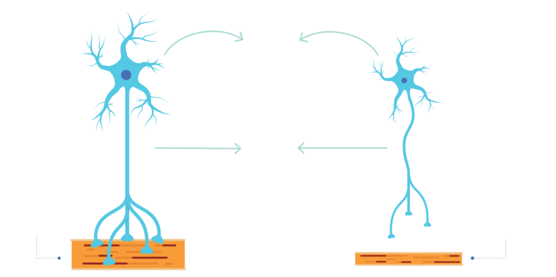 Nedbrytningen av motorneuroner leder till en gradvis reduktion i både muskelmassa och muskelstyrka (atrofi).